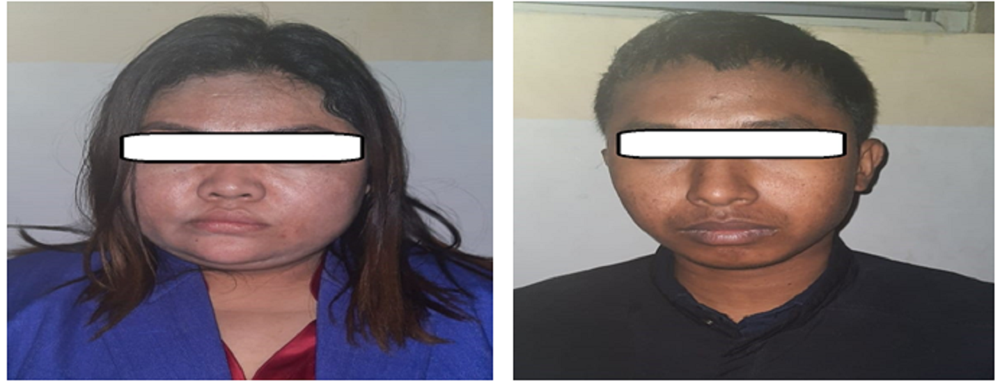 भन्सारका नासुलाई छुटाइदिने भन्दै एक करोड असुली
